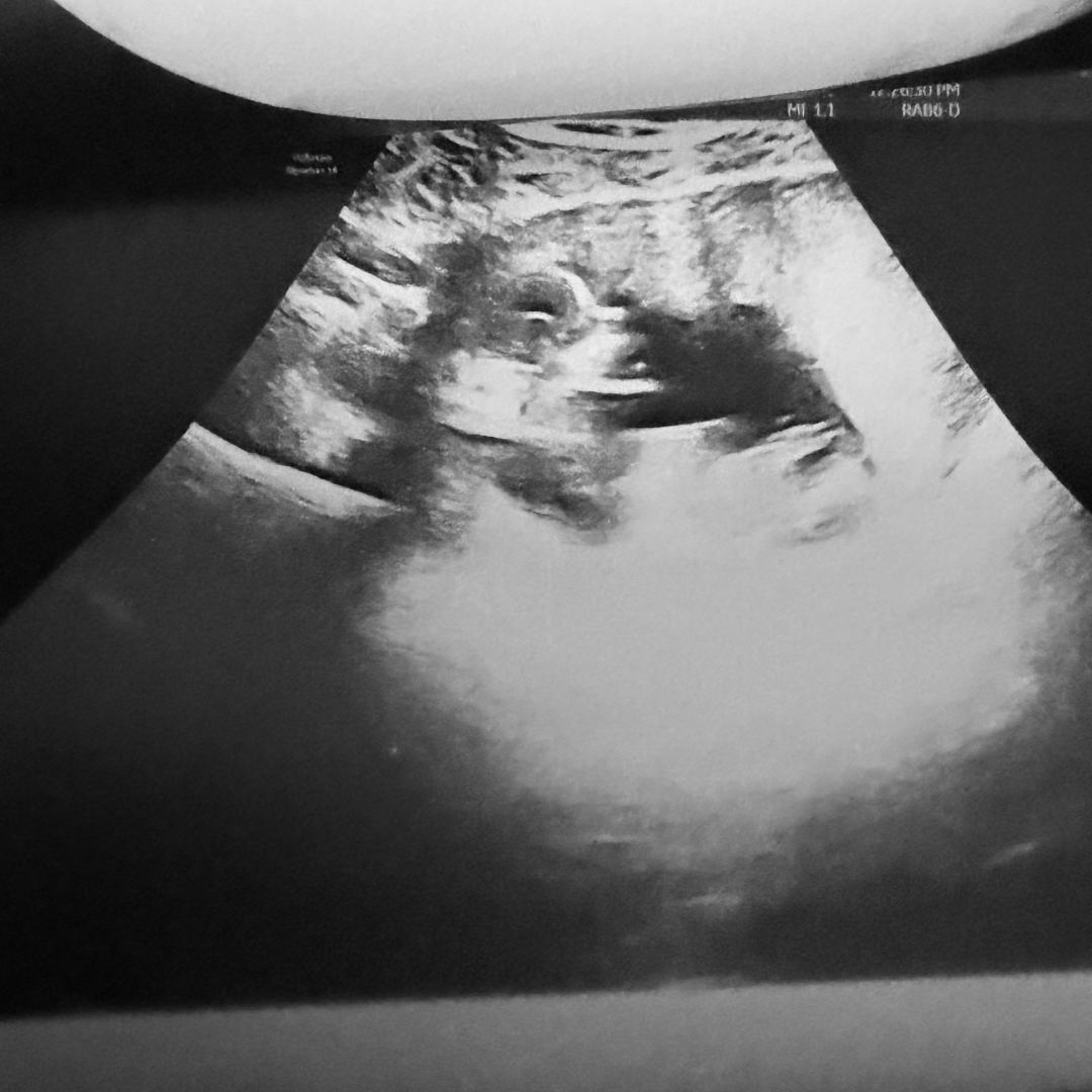 Photo shared by Joshua for their Babylist baby registry.