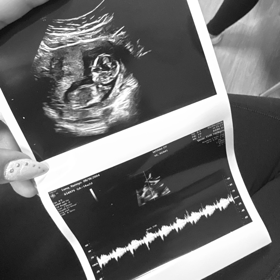 Photo shared by Yazmyn for their Babylist baby registry.