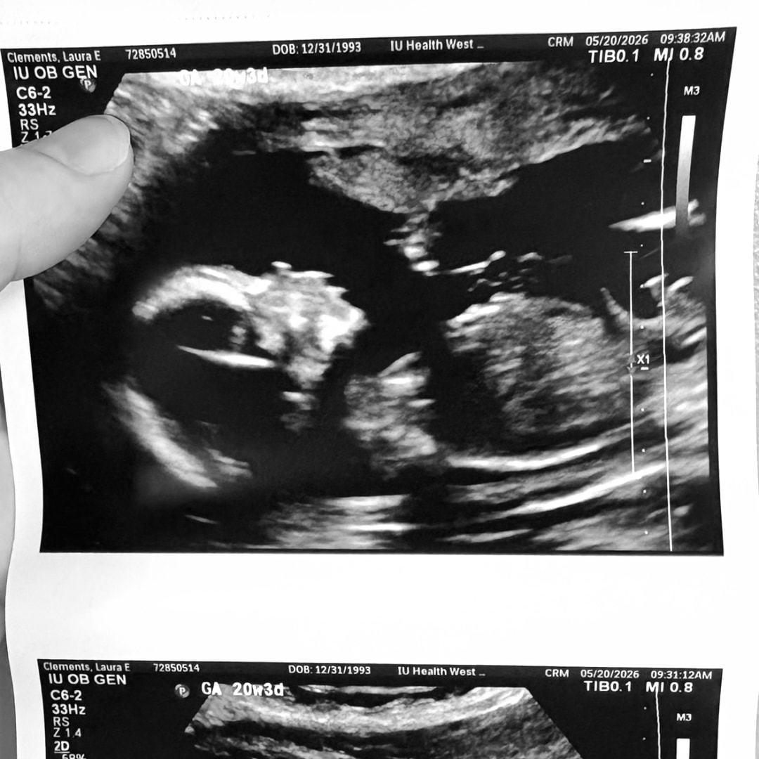 Photo shared by Laura for their Babylist baby registry.