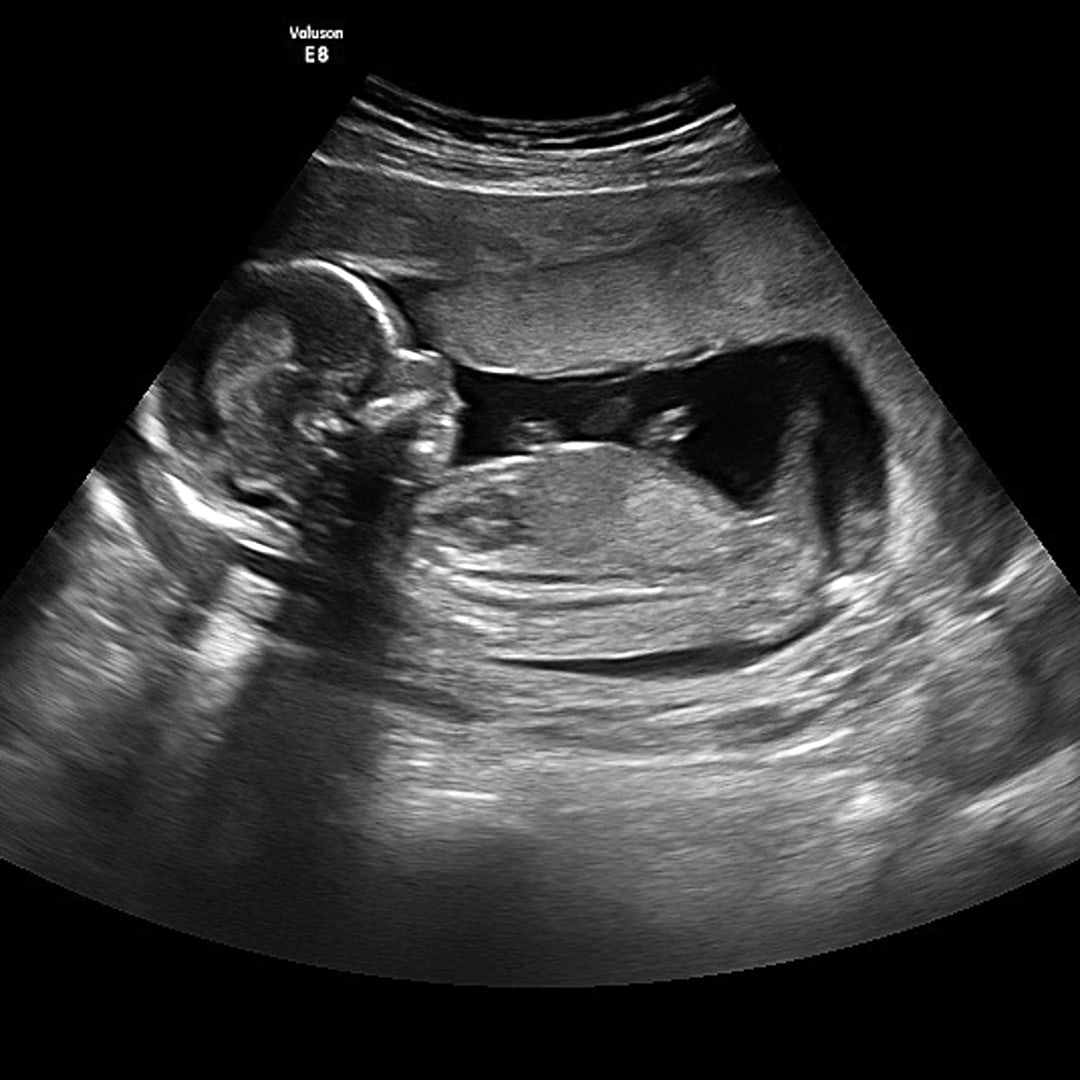 Photo shared by Sarah for their Babylist baby registry.