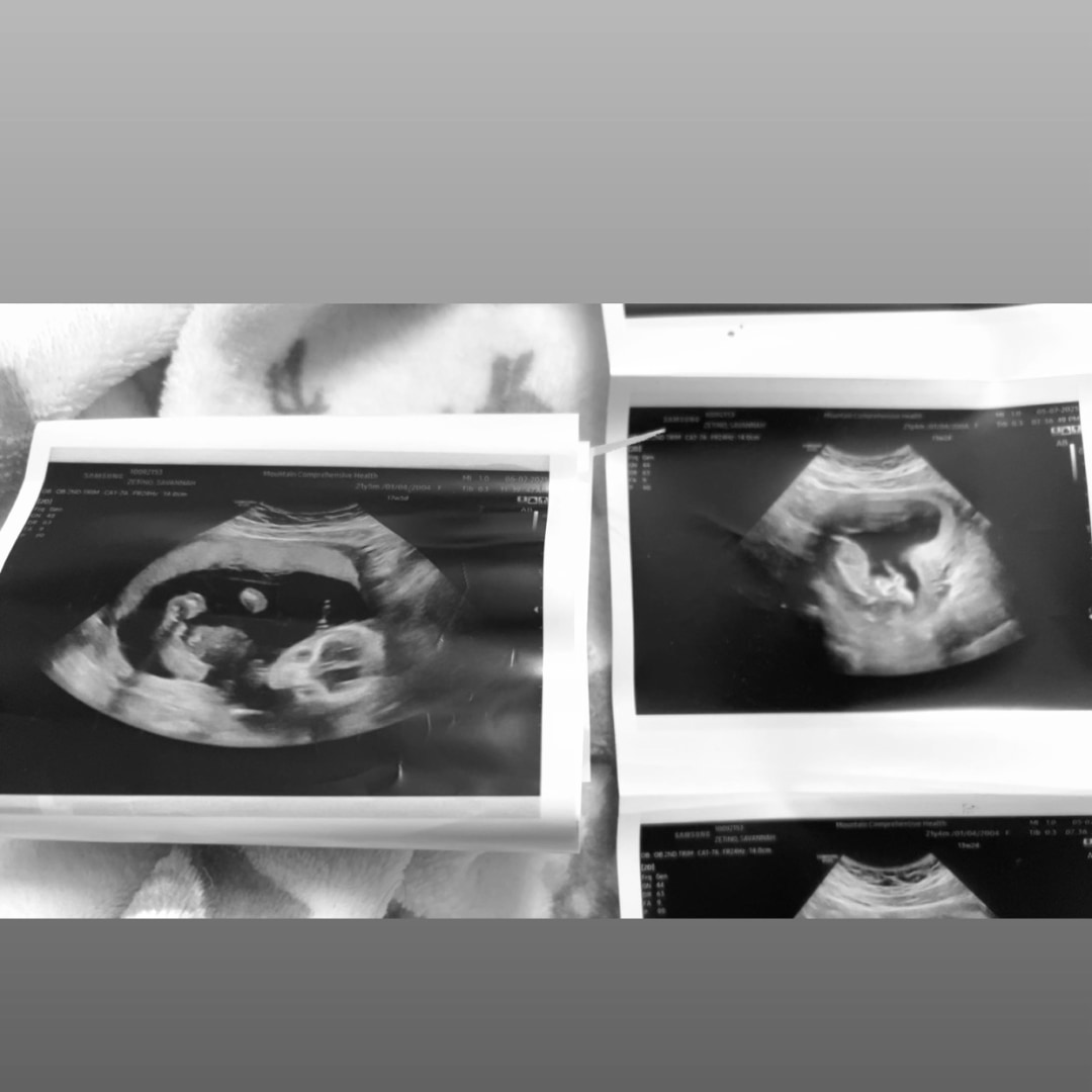 Photo shared by Savannah for their Babylist baby registry.