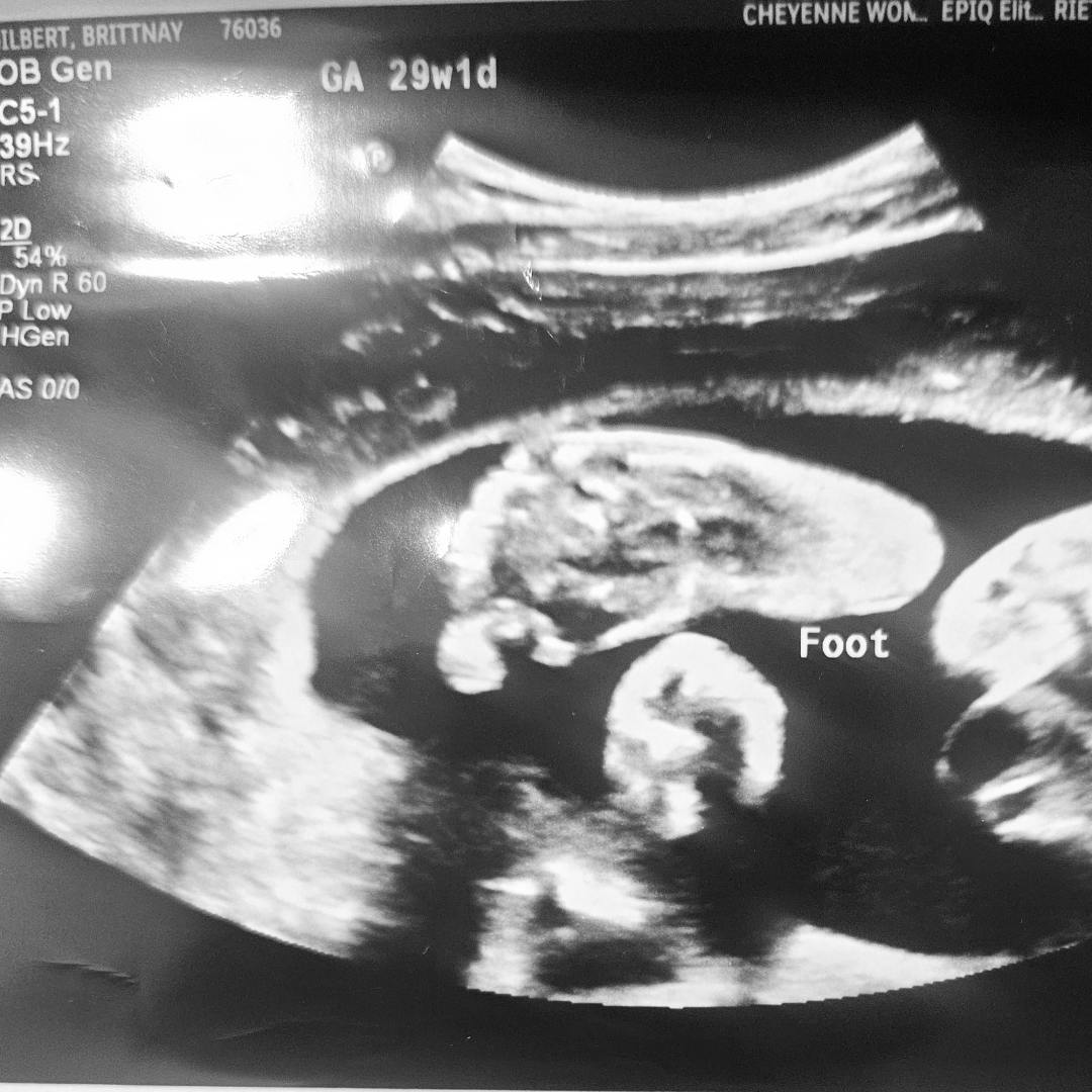 Photo shared by Brittany for their Babylist baby registry.