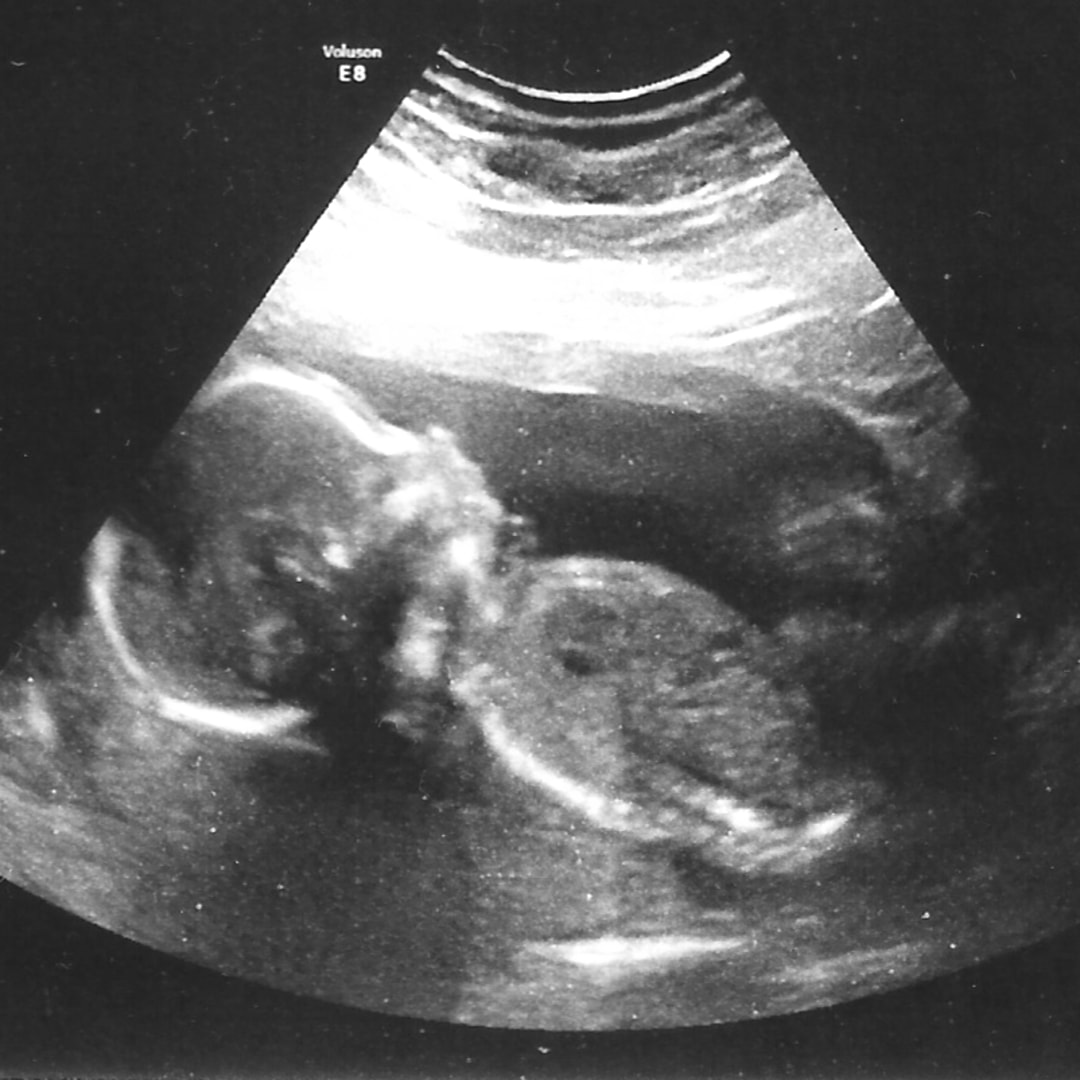 Photo shared by Amanda for their Babylist baby registry.