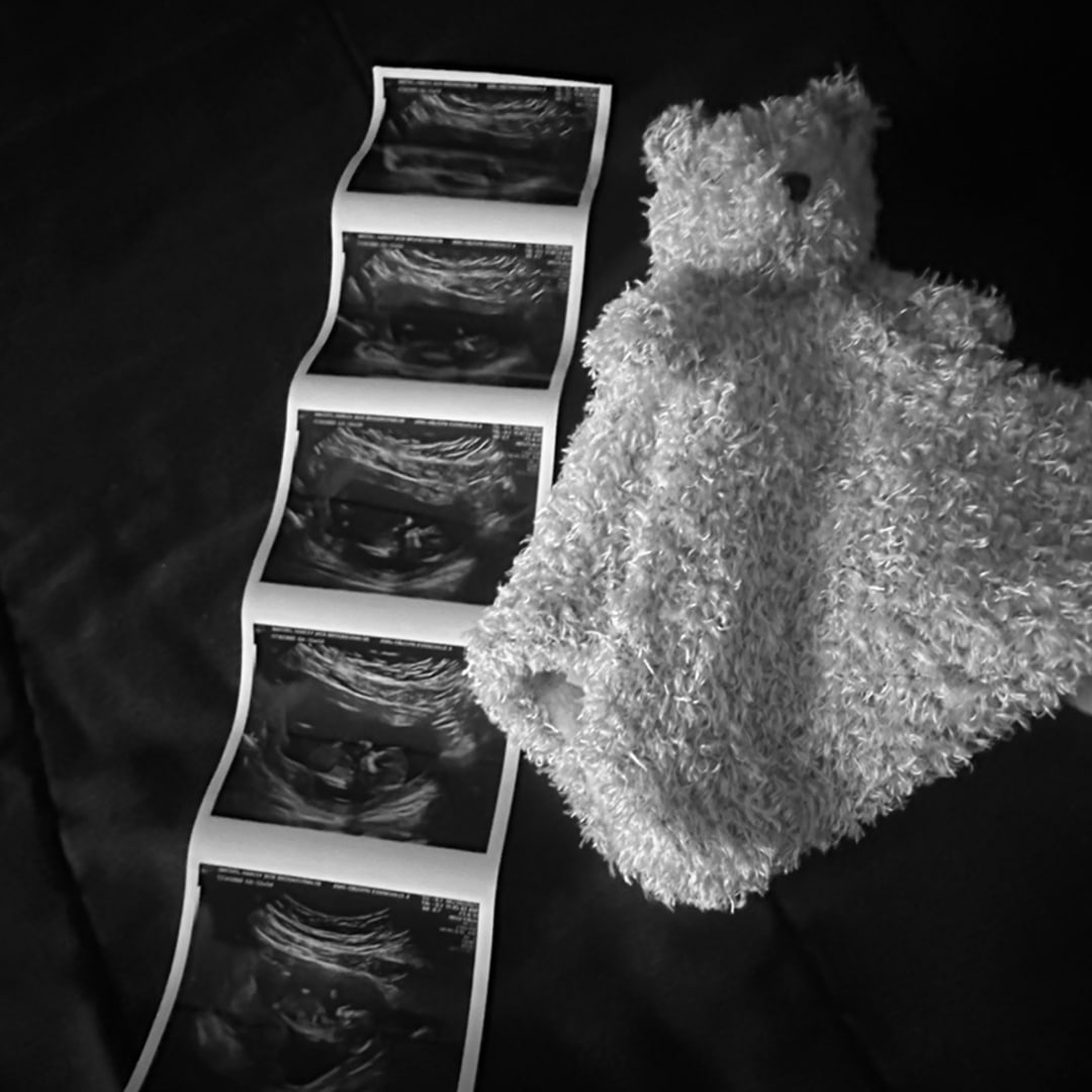Photo shared by Harley for their Babylist baby registry.