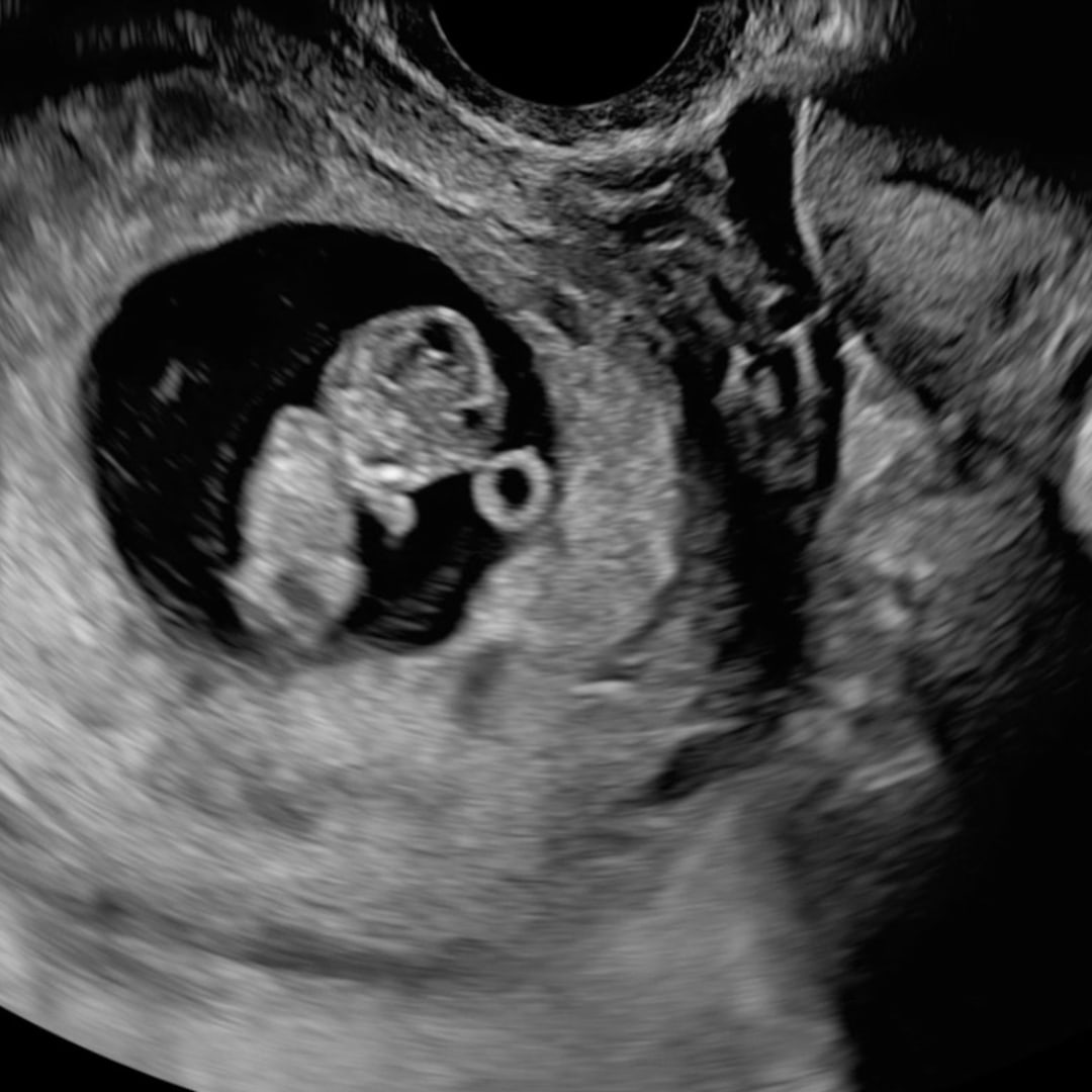 Photo shared by Anna for their Babylist baby registry.