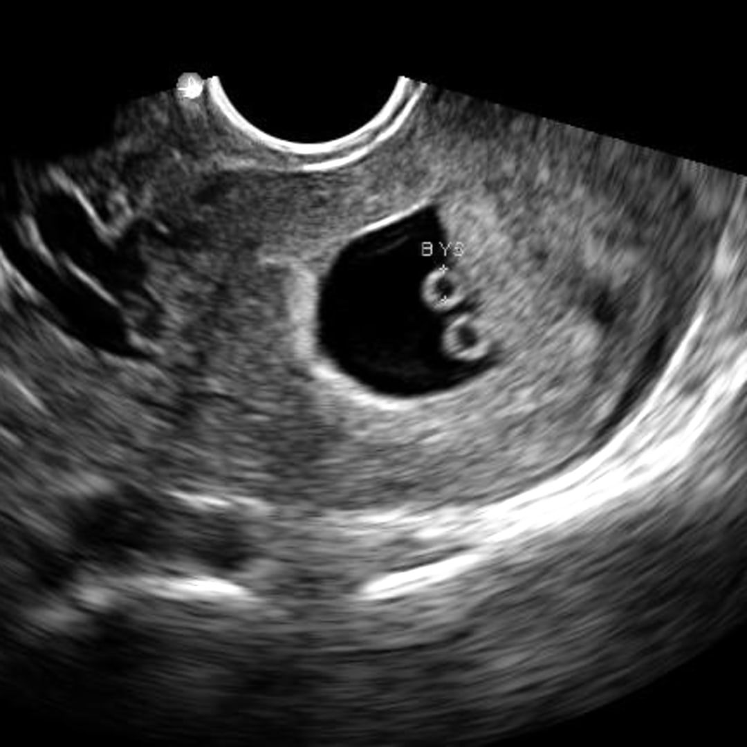 Photo shared by Betty for their Babylist baby registry.