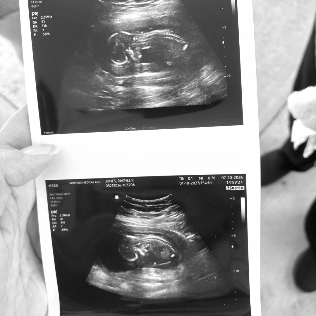 Photo shared by Rachel for their Babylist baby registry.