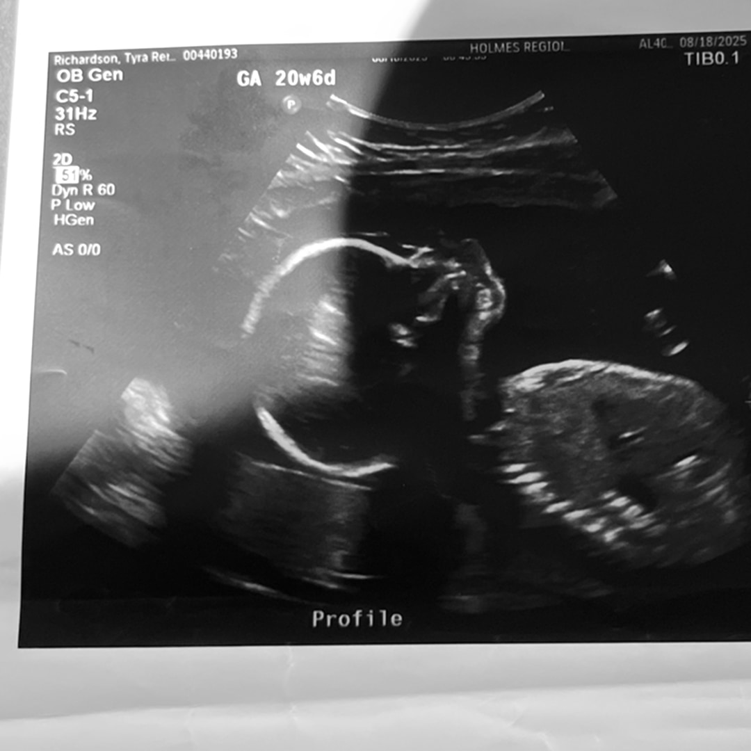 Photo shared by Tyra for their Babylist baby registry.