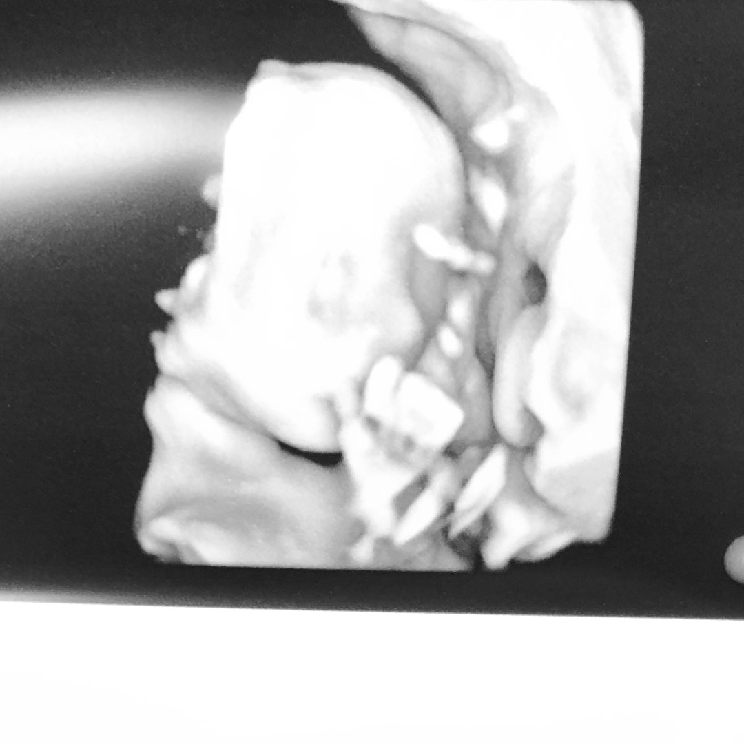 Photo shared by Rylee for their Babylist baby registry.