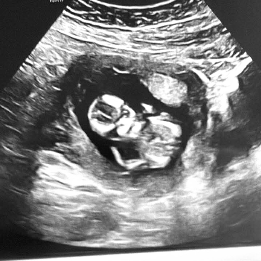 Photo shared by Cameo for their Babylist baby registry.