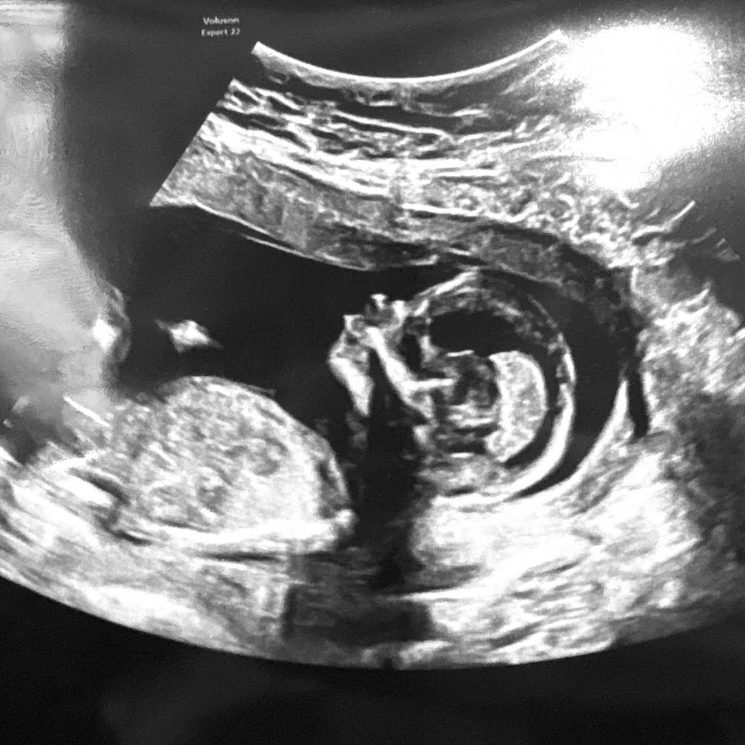 Photo shared by Sarah for their Babylist baby registry.