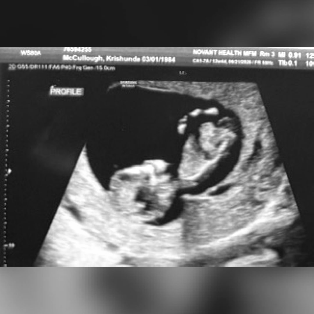 Photo shared by Krishunda for their Babylist baby registry.