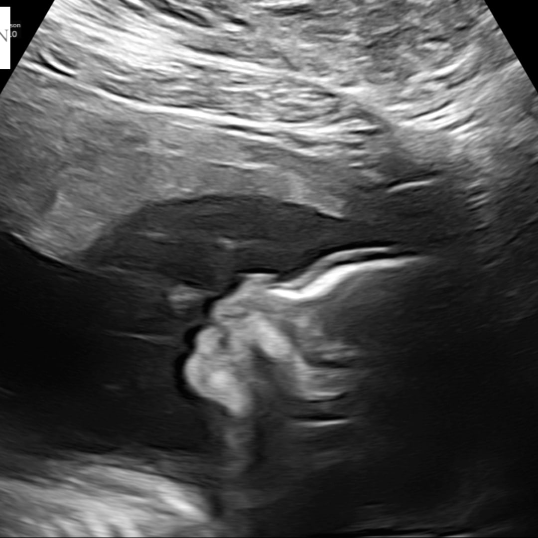 Photo shared by Julie for their Babylist baby registry.