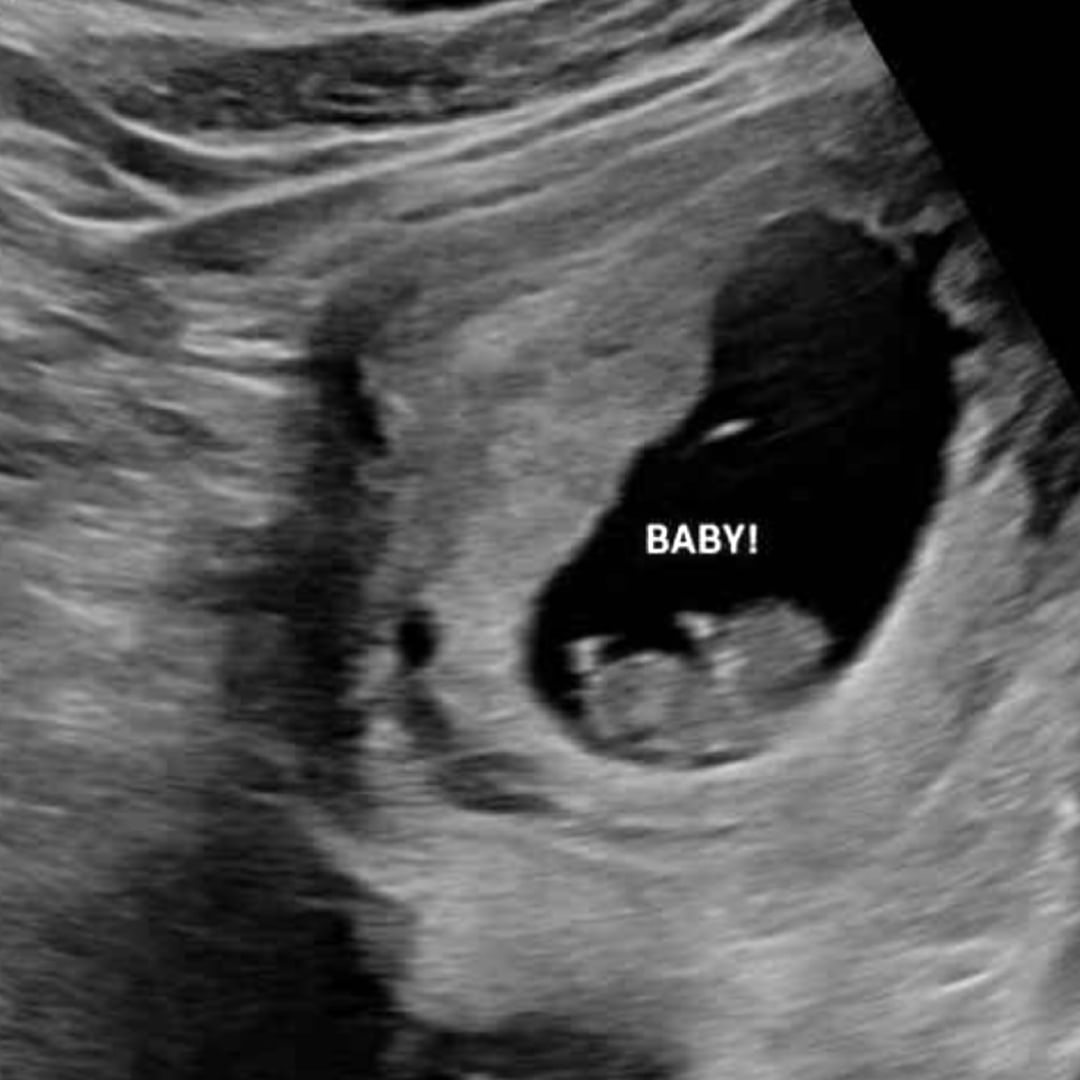 Photo shared by Cameryn for their Babylist baby registry.