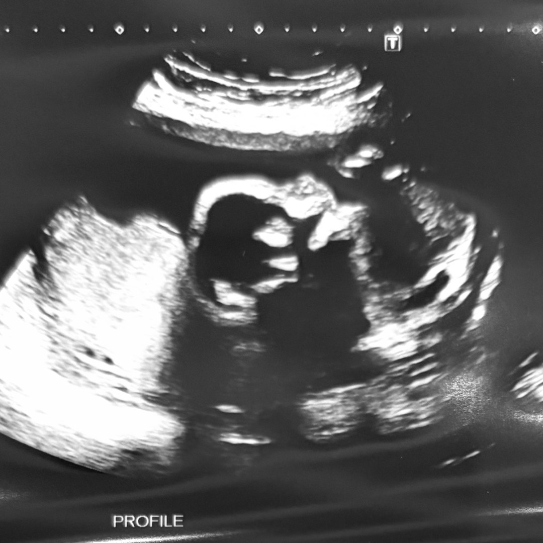 Photo shared by Kaitlyn for their Babylist baby registry.
