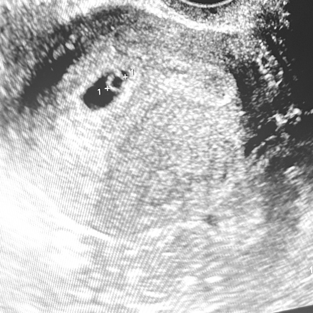 Photo shared by Emily for their Babylist baby registry.