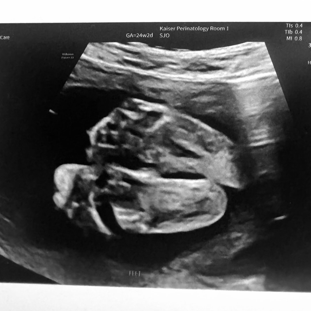 Photo shared by Christie for their Babylist baby registry.