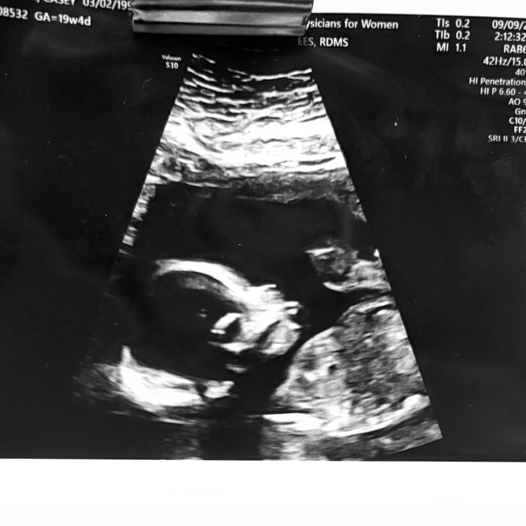 Photo shared by Casey and Stuart for their Babylist baby registry.