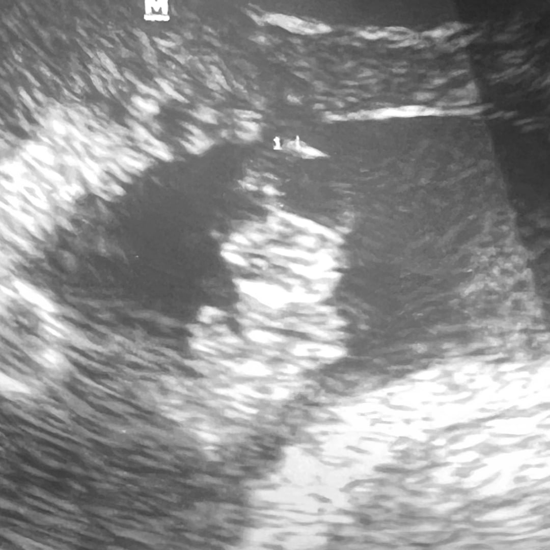 Photo shared by Bree for their Babylist baby registry.