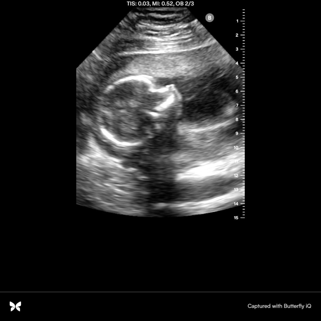 Photo shared by Tesla for their Babylist baby registry.