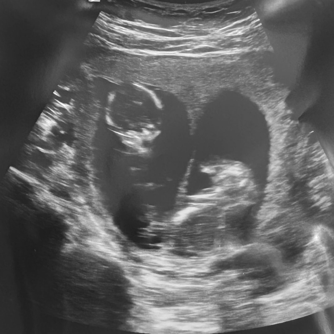 Photo shared by Alli for their Babylist baby registry.