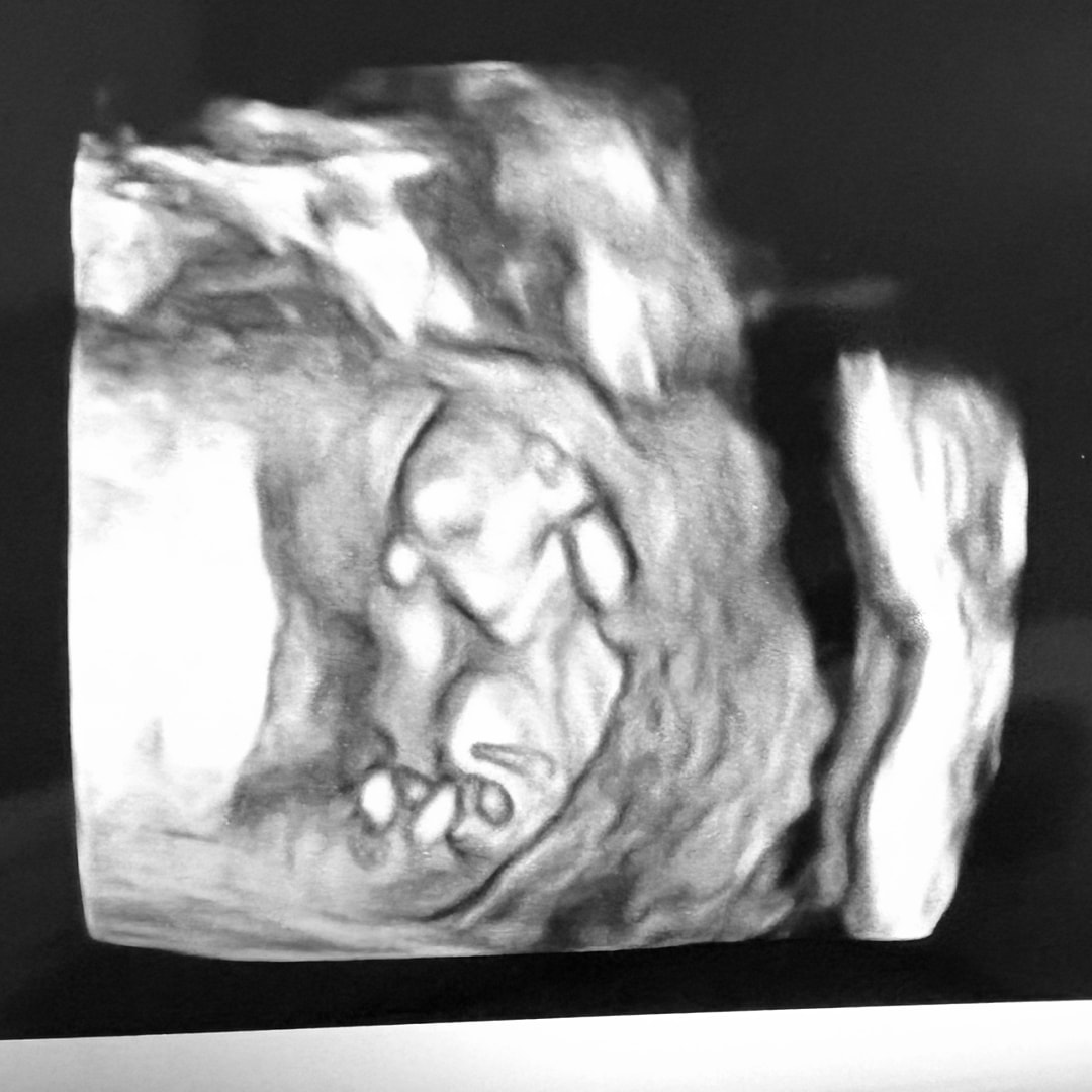 Photo shared by Juliana for their Babylist baby registry.