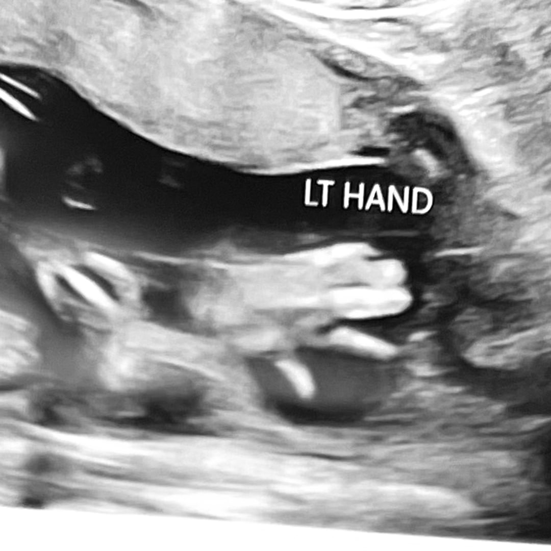 Photo shared by Christina for their Babylist baby registry.