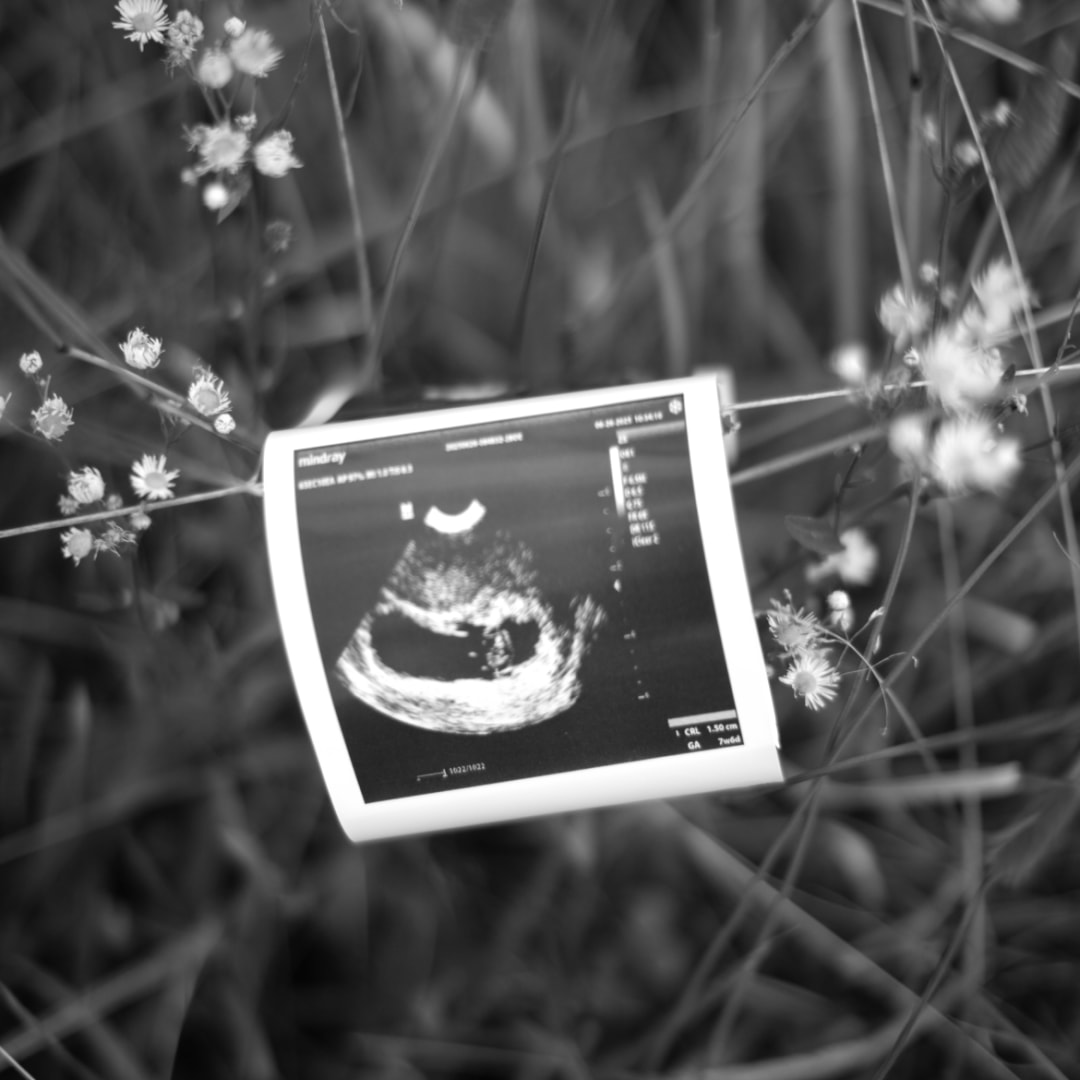 Photo shared by Rachael-Catherine for their Babylist baby registry.