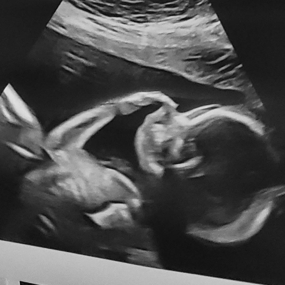 Photo shared by Rebecca for their Babylist baby registry.