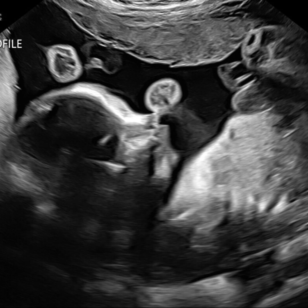 Photo shared by Leslie for their Babylist baby registry.