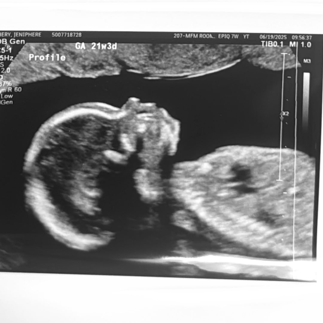 Photo shared by Jeniphere for their Babylist baby registry.