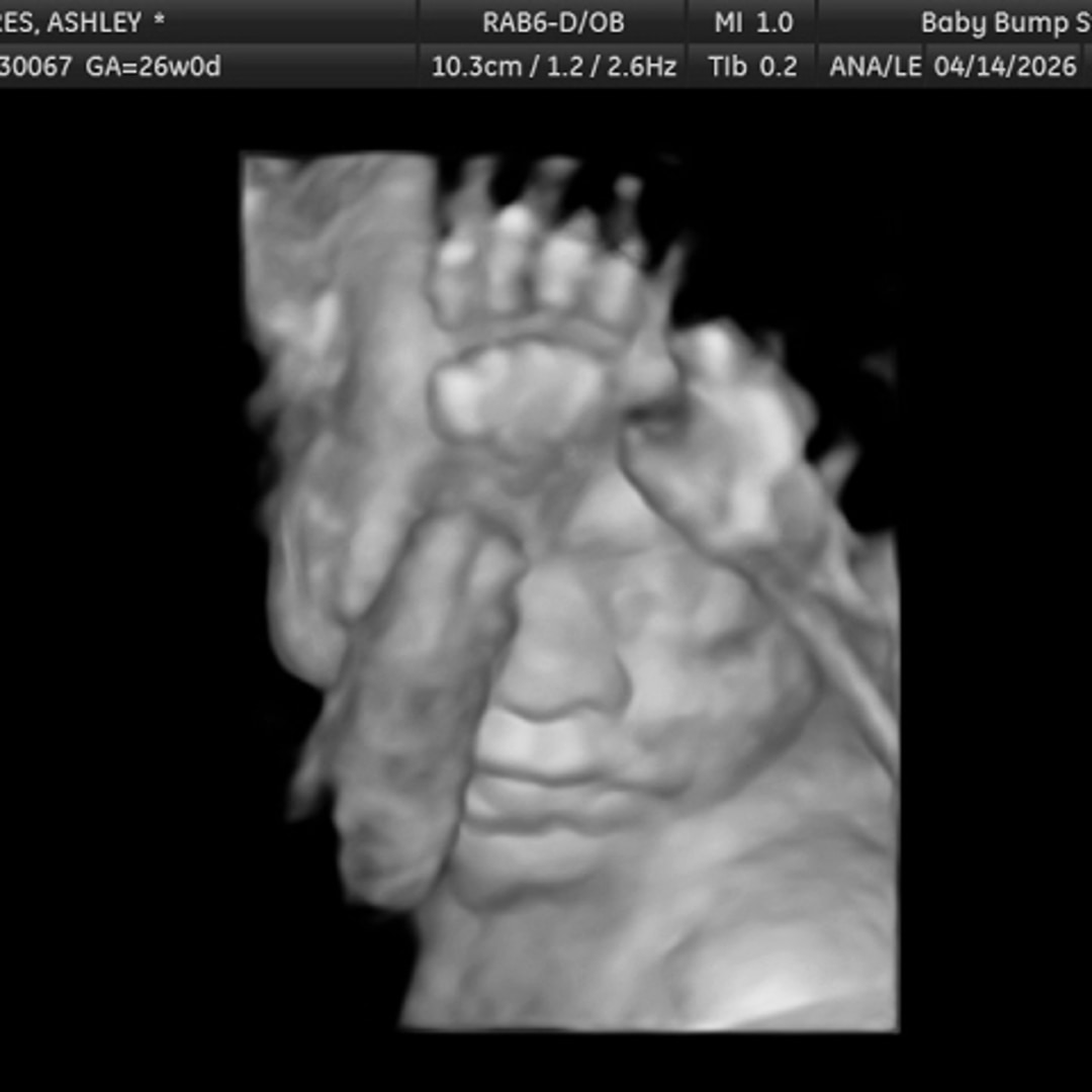 Photo shared by Ashley for their Babylist baby registry.