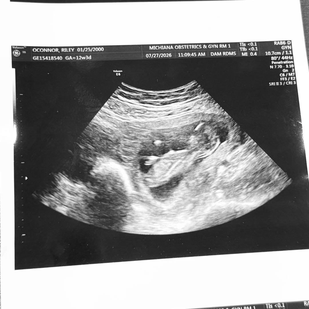 Photo shared by Riley for their Babylist baby registry.