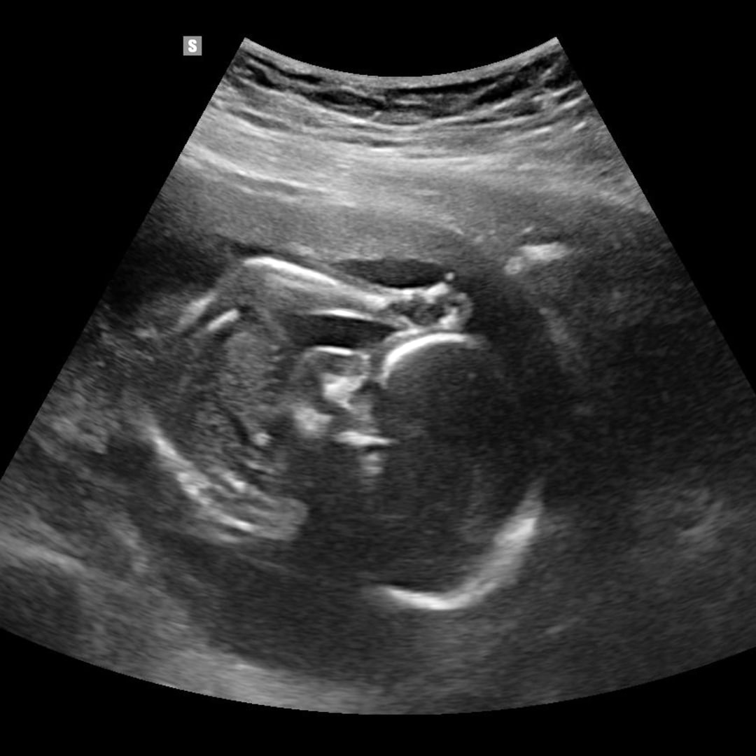 Photo shared by Sonia for their Babylist baby registry.