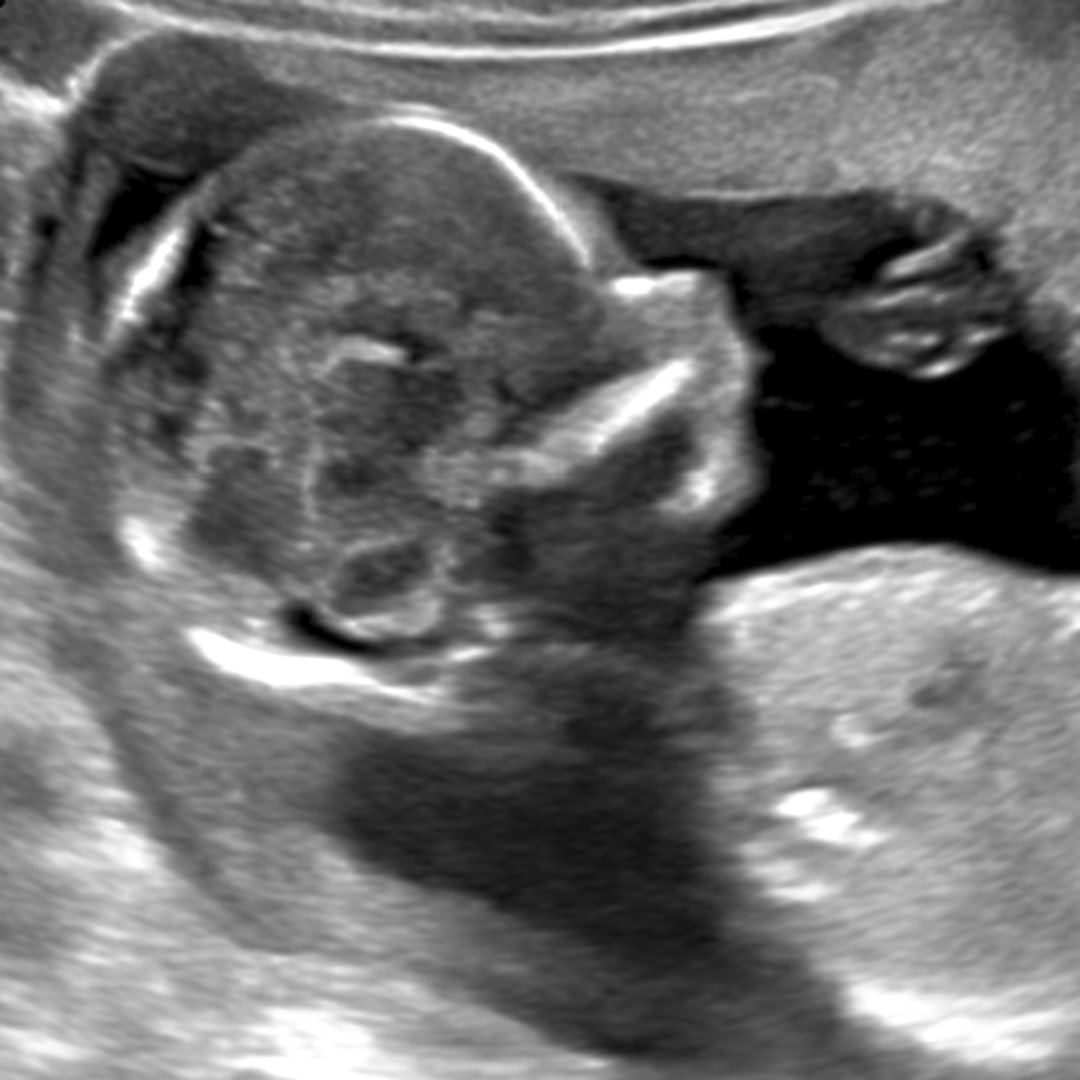 Photo shared by Cayley for their Babylist baby registry.