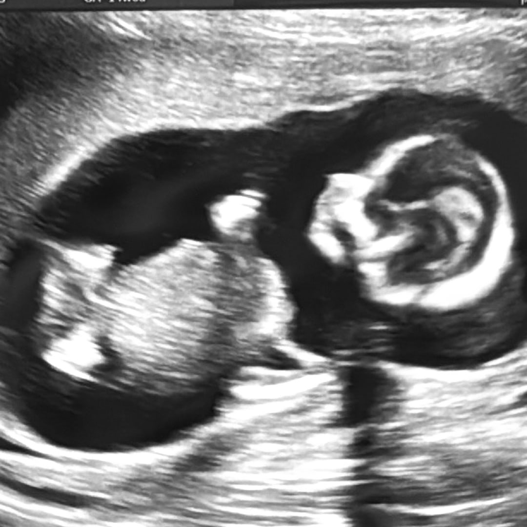 Photo shared by Cheyenne for their Babylist baby registry.