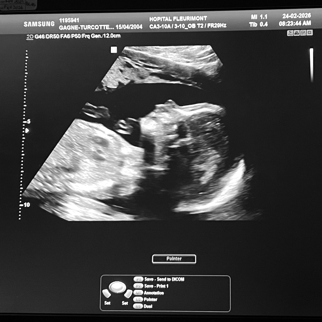 Photo shared by Alyson for their Babylist baby registry.