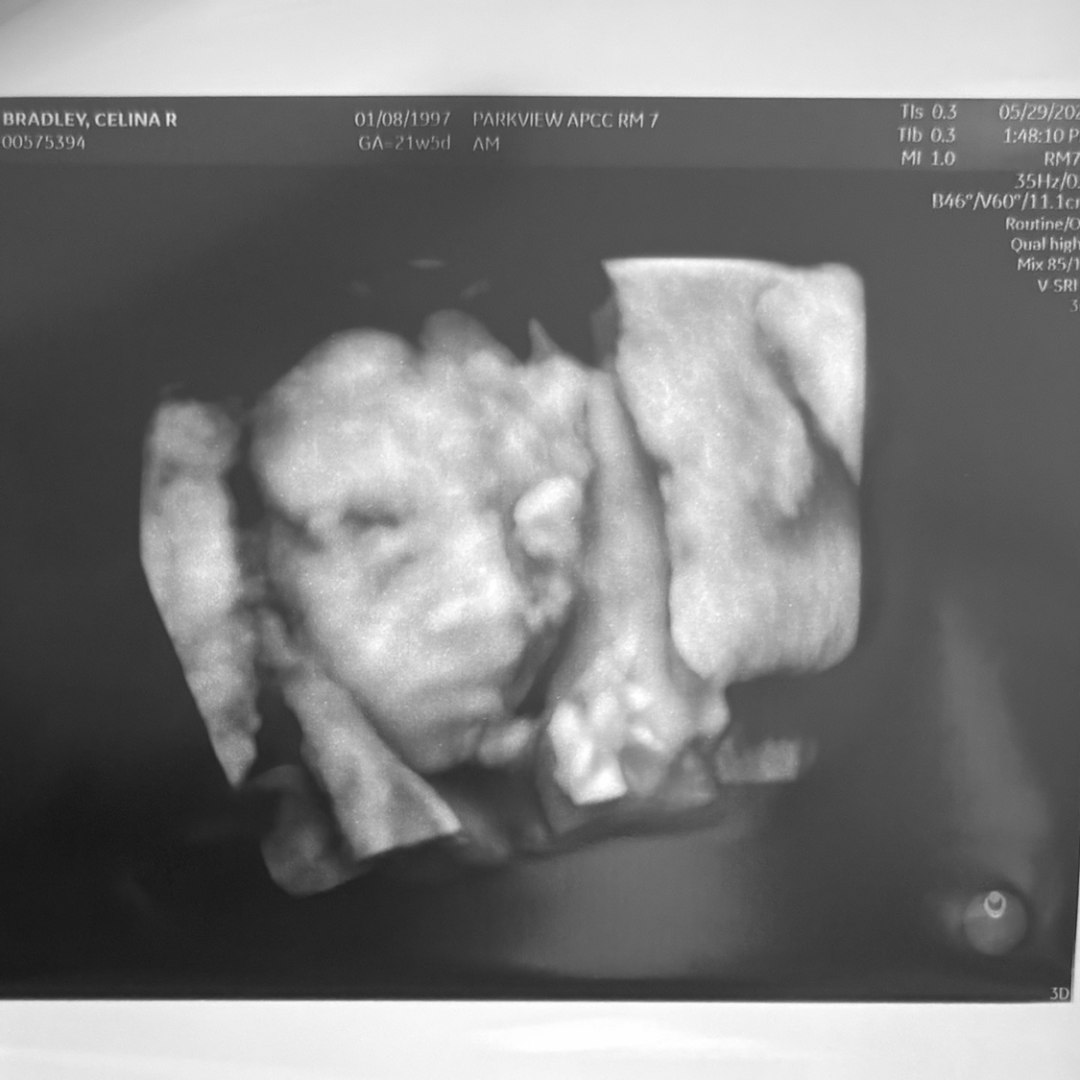 Photo shared by Dalton for their Babylist baby registry.