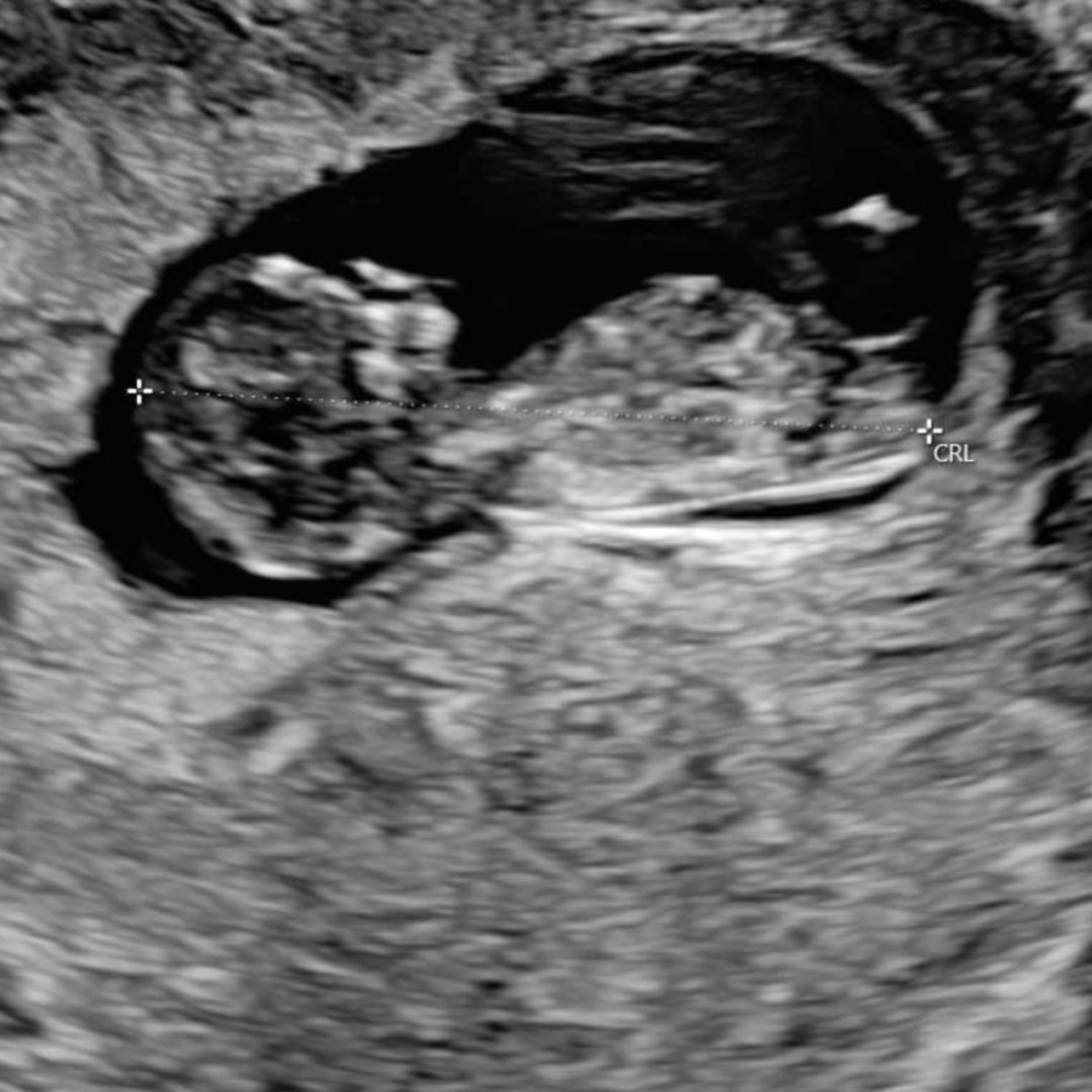 Photo shared by Shawn for their Babylist baby registry.