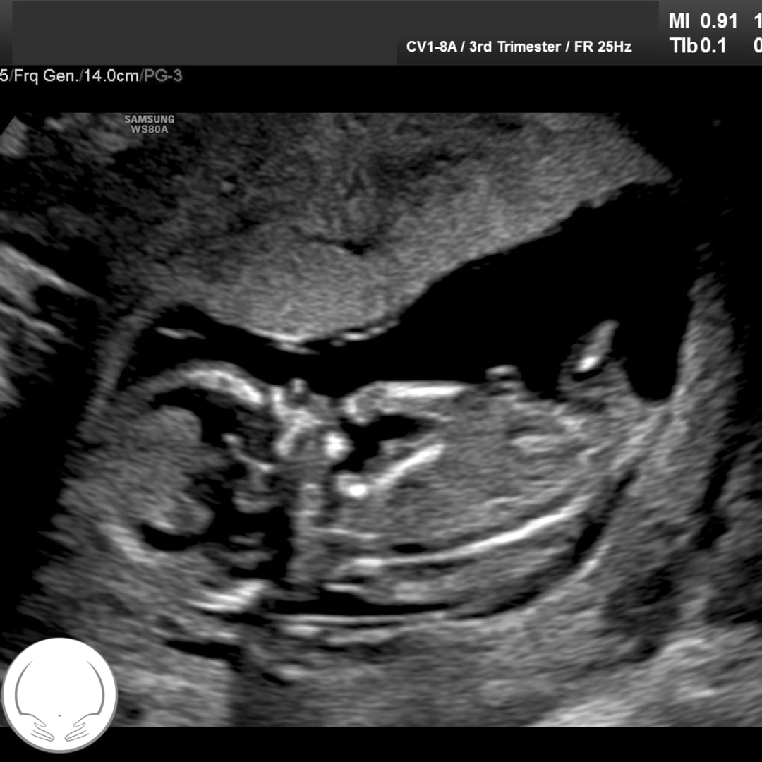 Photo shared by Jade for their Babylist baby registry.