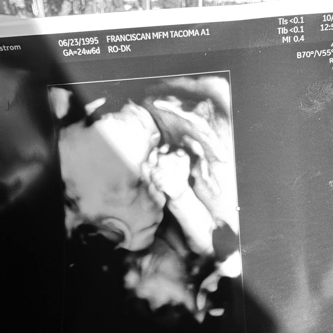 Photo shared by Brittney for their Babylist baby registry.