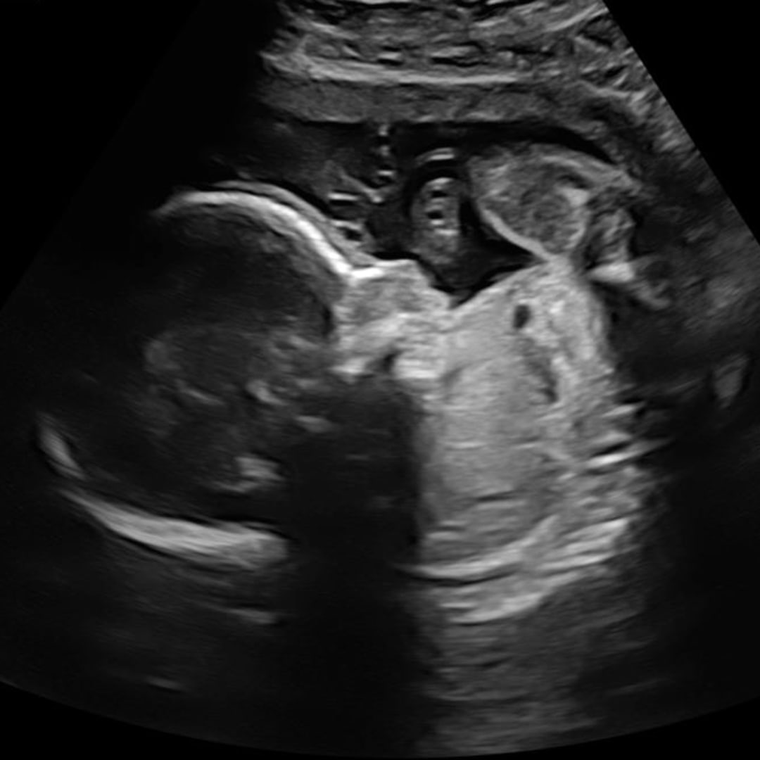 Photo shared by Gracie for their Babylist baby registry.