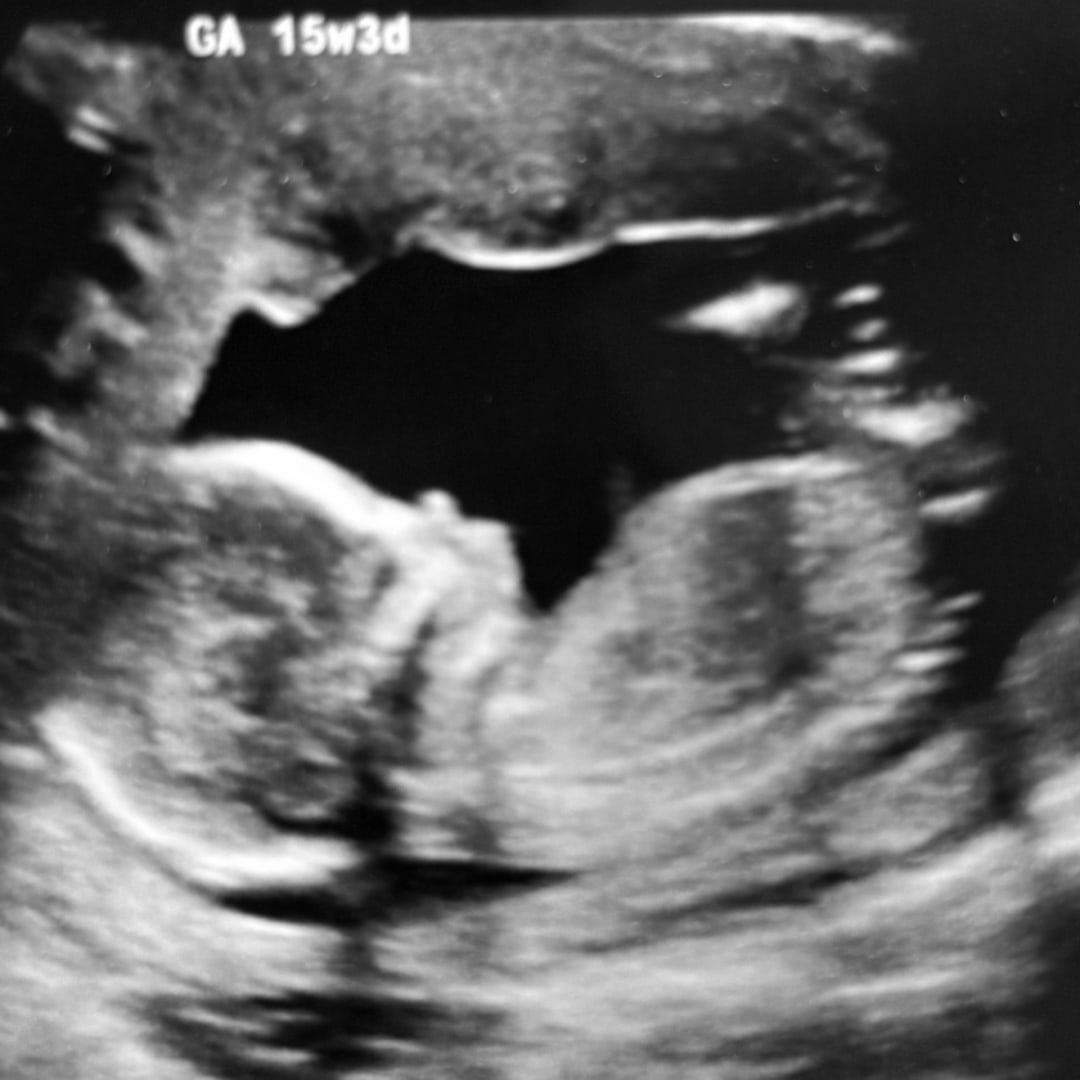 Photo shared by Natalia for their Babylist baby registry.