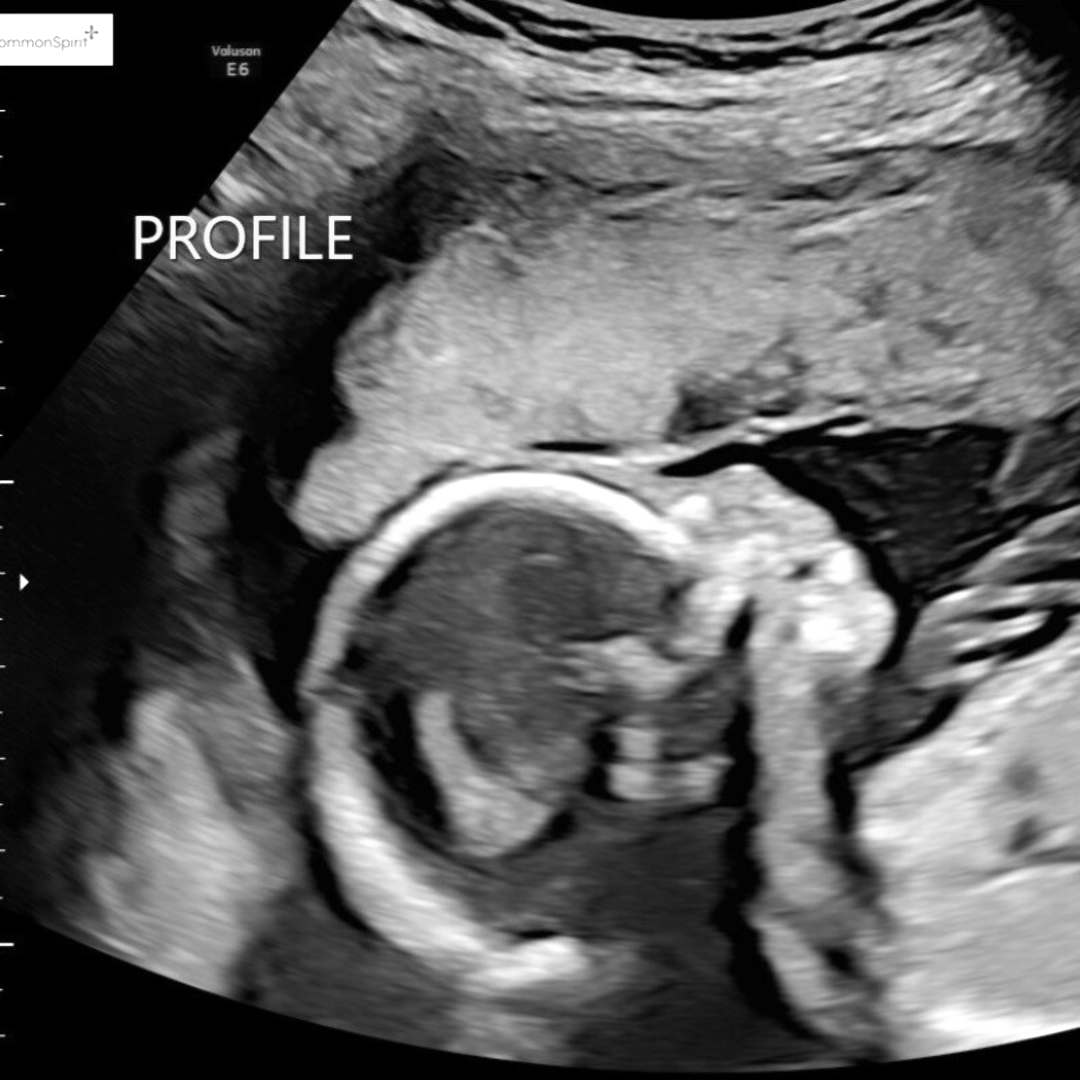 Photo shared by Ashlyn for their Babylist baby registry.