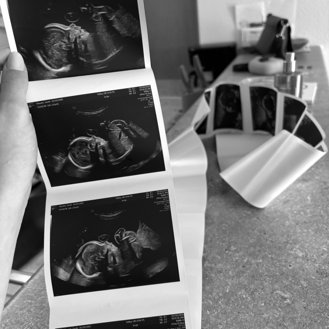 Photo shared by Sarah for their Babylist baby registry.