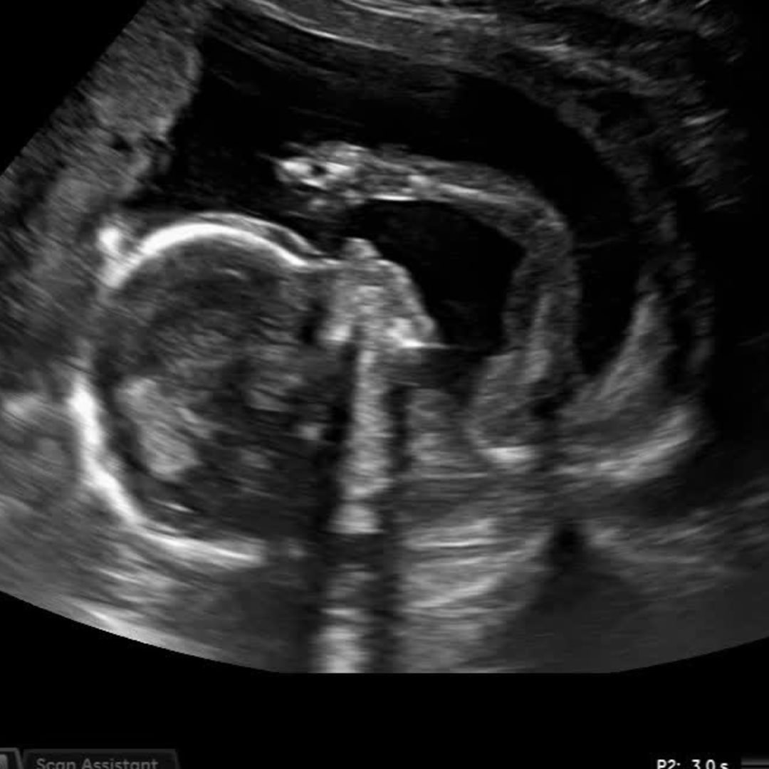 Photo shared by Hannah for their Babylist baby registry.