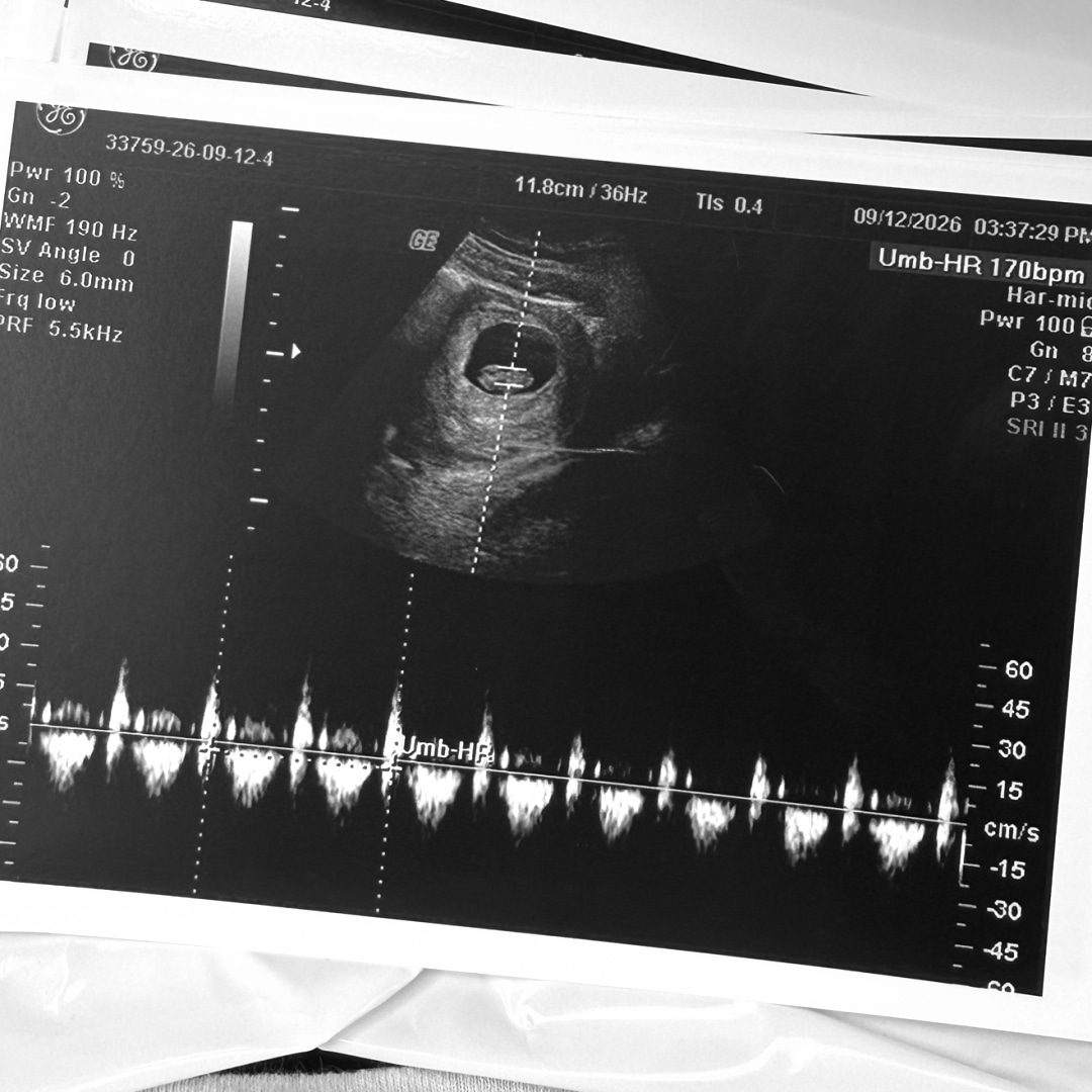 Photo shared by Alexa for their Babylist baby registry.