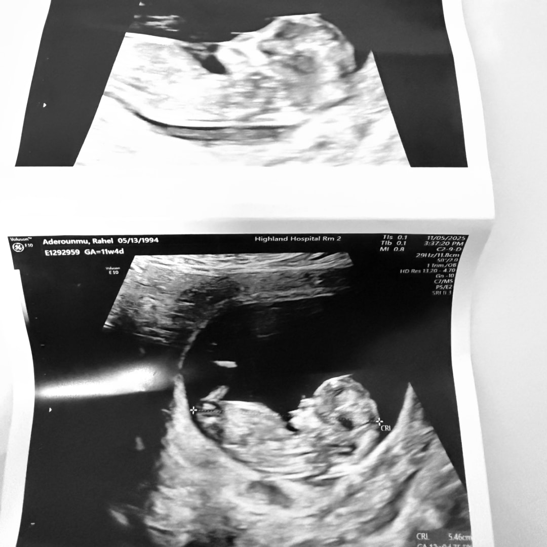 Photo shared by Rahel for their Babylist baby registry.