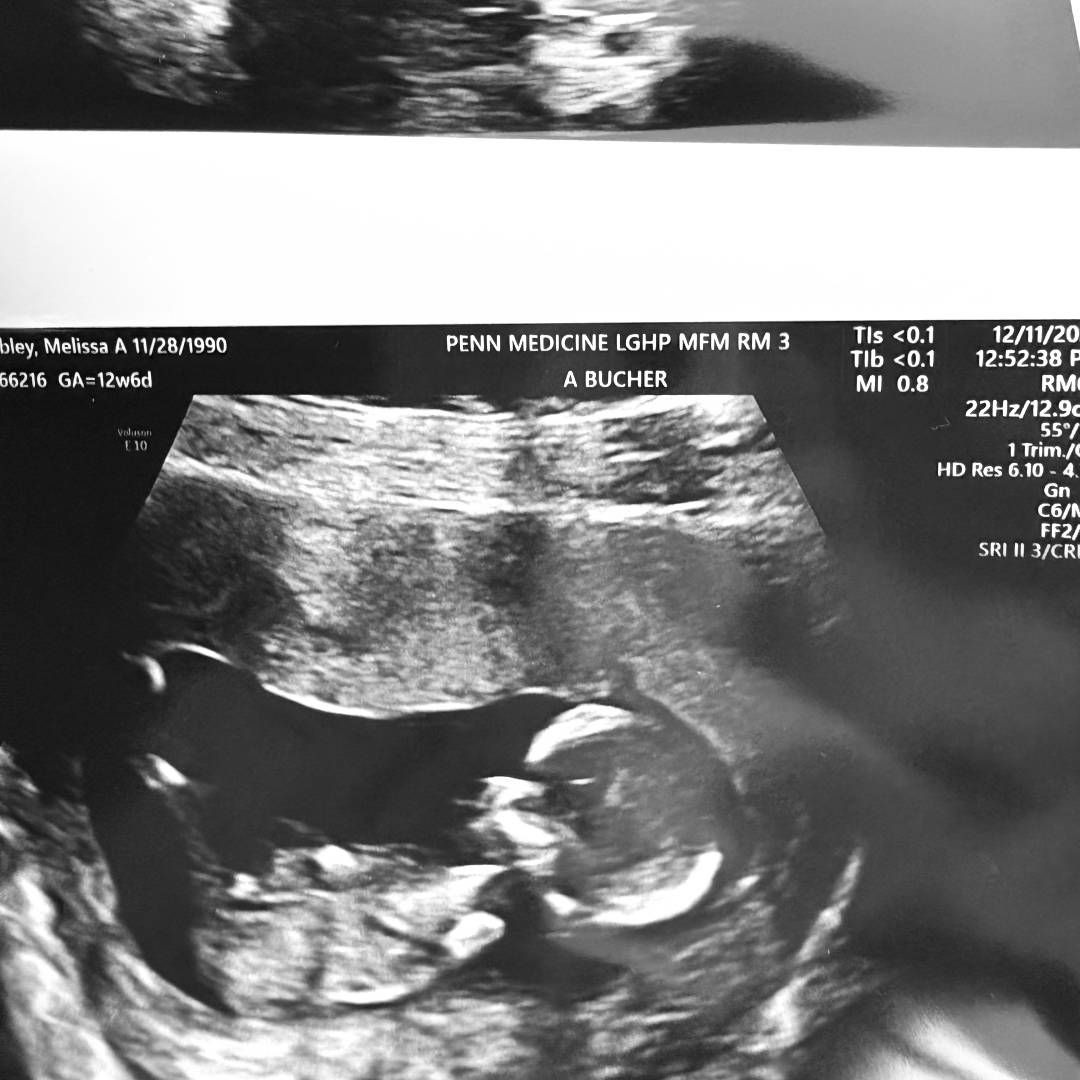 Photo shared by Melissa for their Babylist baby registry.