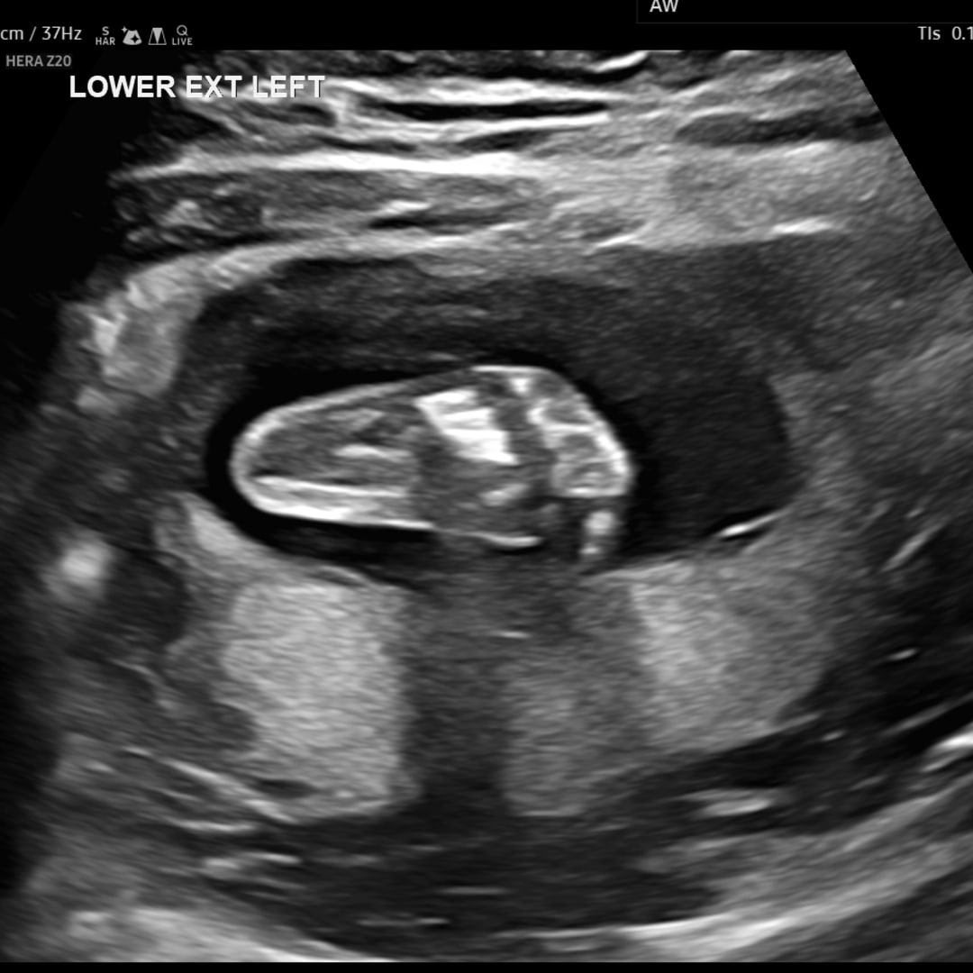 Photo shared by Jillian for their Babylist baby registry.